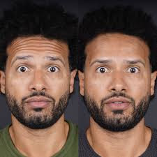 Anti-wrinkle 3 zones (man)
