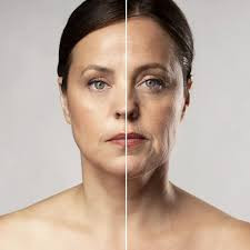 Full face with Botox