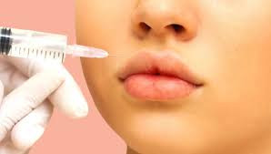Facial fillers (2ml)