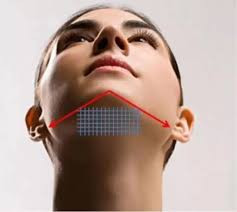 Facial Contouring (from 3ml)