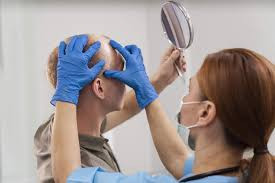 Hair Restoration Consultation