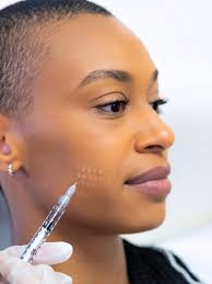 Skin booster
